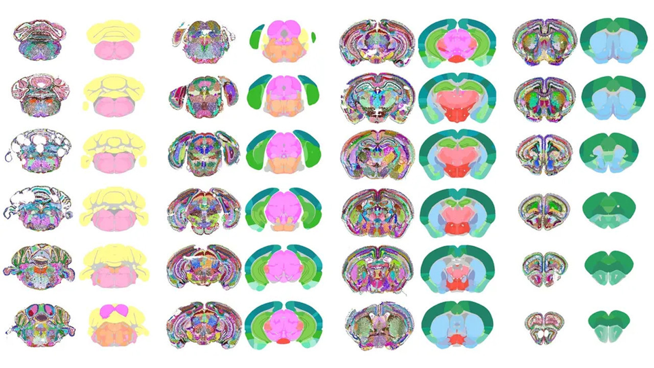 Yapay zeka, beyindeki sır perdesini de kaldırıyor